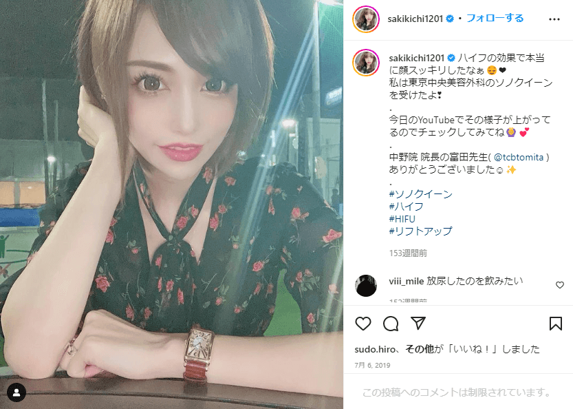サキ吉さんのTCB東京中央美容外科に関するInstagram投稿