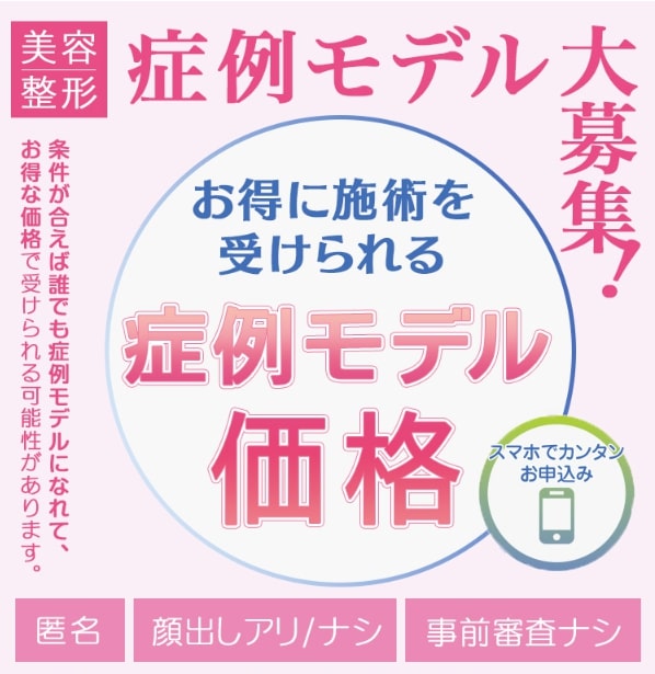 TCB東京中央美容外科の症例モデル（モニター）割引